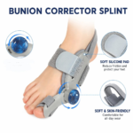adjustable bunion splint